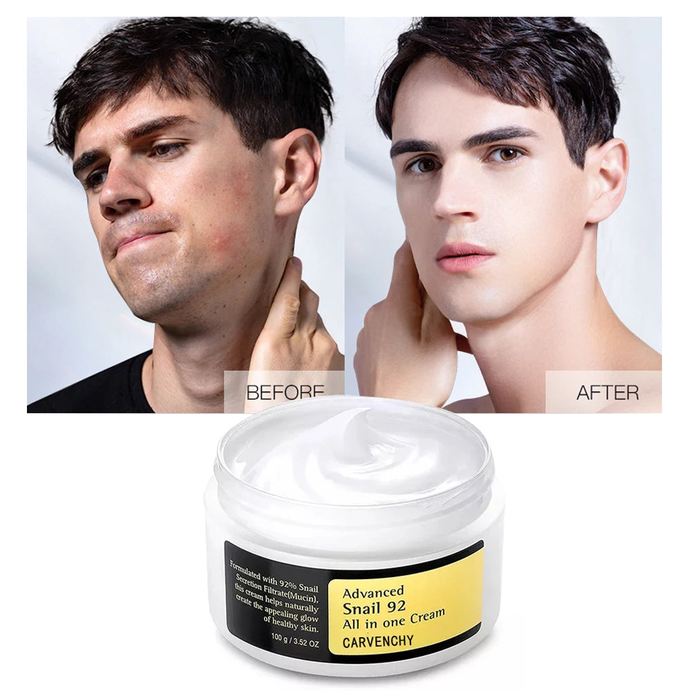 100ml Schnecken mucin Kraft Reparatur Essenz, Gesichts creme feuchtigkeit spendende Serum schrumpfen Poren Akne-Behandlung Reparatur beschädigte Gesichts pflege