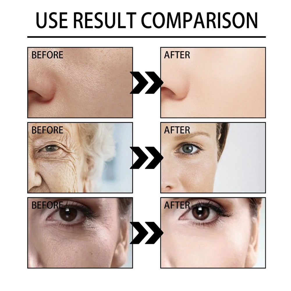 100ml Schnecken mucin Kraft Reparatur Essenz, Gesichts creme feuchtigkeit spendende Serum schrumpfen Poren Akne-Behandlung Reparatur beschädigte Gesichts pflege